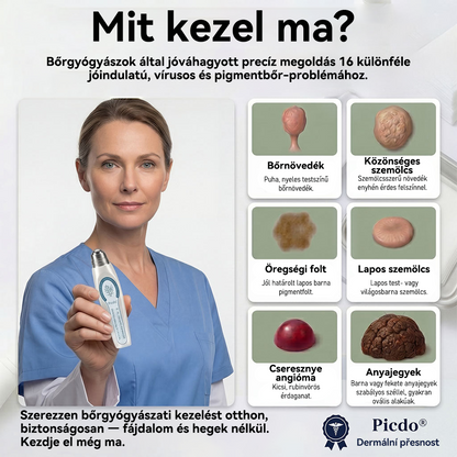 Hivatalos márkabolt | ✅🎉 Picdo® 7 napos bőrfütyök és folteltávolító (fájdalommentes, heg nélküli rollerball kezelés)