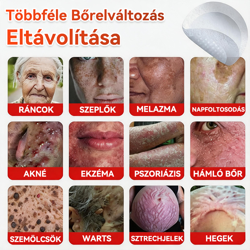 🔥✅ GFOUK® Mikrotűs növényi bőrkinövés eltávolító tapasz
