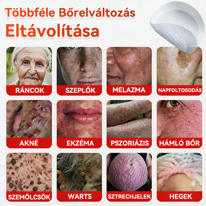 🔥✅ GFOUK® Mikrotűs növényi bőrkinövés eltávolító tapasz