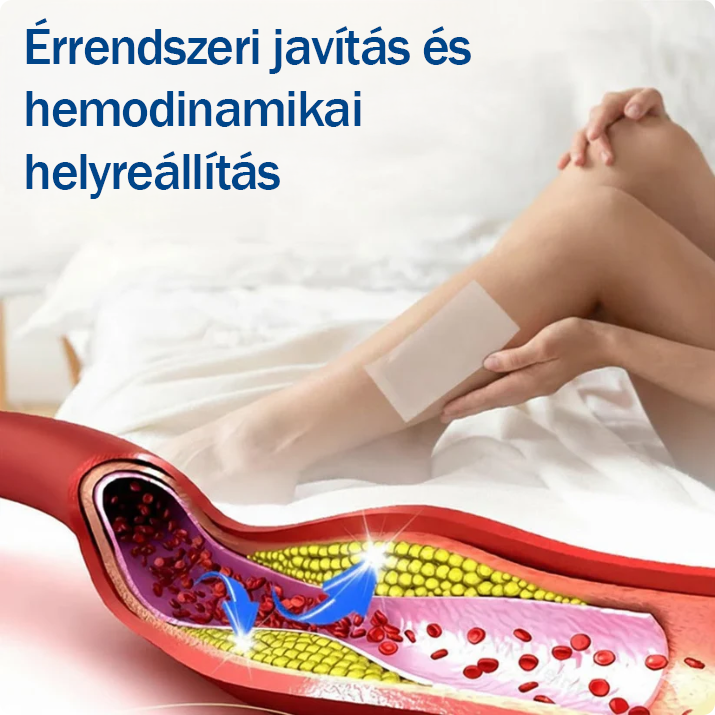 ❤️🇭🇺👨‍⚕️✅TAILEDEN® VeinEase Mikrotűs Kezelő Tapasz⚡Azonnali Megkönnyebbülés, Hosszú Távú Eredmények